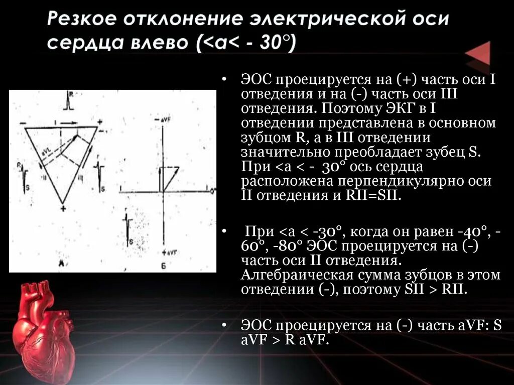 Смещение электрической оси сердца влево на ЭКГ. Отклонение оси сердца влево на ЭКГ. Отклонение осей сердца на ЭКГ. Отклонение от оси сердца вправо на ЭКГ. Сердце отклонено вправо