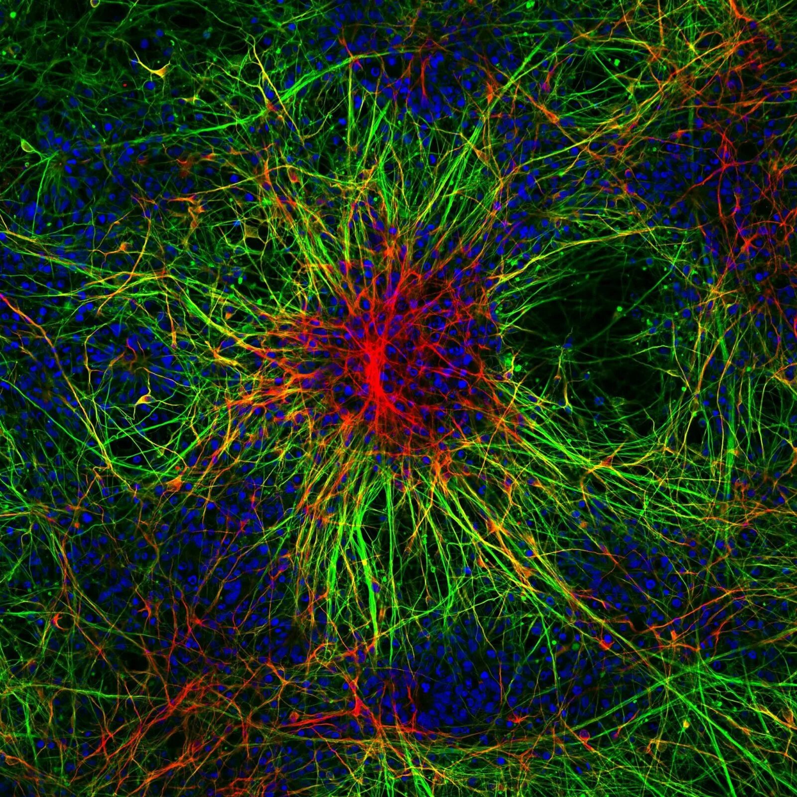 Нейронная сеть человеческого мозга. Нейрон Пуанкаре микрофотография. Нейронная клетка. Клетки головного мозга. Нейронная сеть мозга.