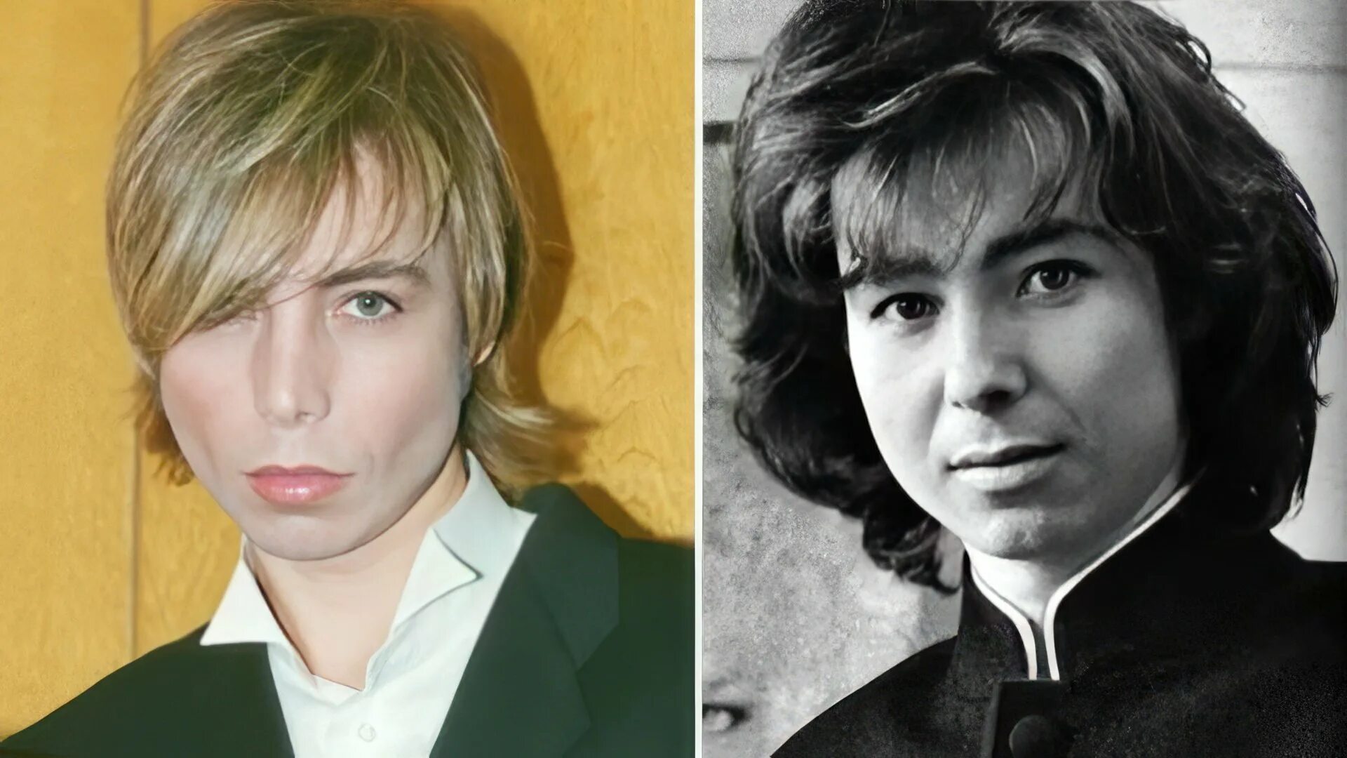 Сергей Зверев до и после пластических операций, фото и видео
