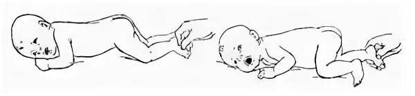 Рефлекс бауэра. Рефлекс ползания (рефлекс бауэра). Рефлекс ползания у новорожденных. Рефлекс бауэра. Рефлекс бауэра рефлекс бауэра.