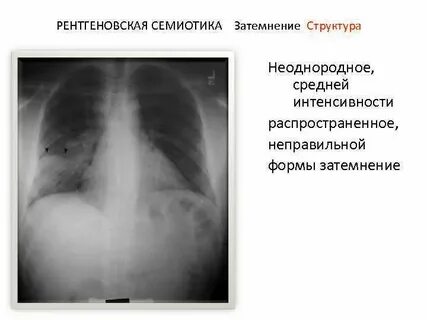 Затемнение неправильной формы