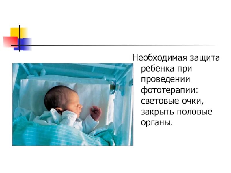 Фототерапия алгоритм. Алгоритм проведения фототерапии. фототерапия для новорожденных алгоритм. при проведении фототерапии на ребенка. защита при фототерапии.