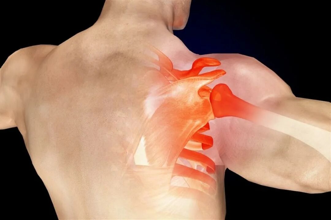 Воспаление плечевого сустава. Разрыв плечевого сустава симптомы