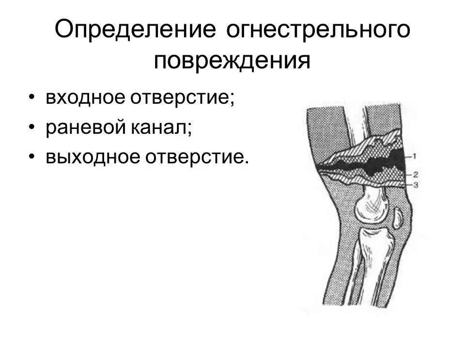 Сквозное огнестрельное ранение. Классификация огнестрельной травмы. Огнестрельные ранения травматология. Огнестрельные ранения суставов конечностей. Огнестрельные ранения травматология.