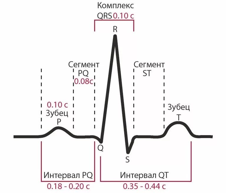 Расшифровка данных экг. Длительность интервалов на экг норма. нормальные показатели зубцов и интервалов экг. продолжительность зубцов и интервалов экг в норме. экг нормальные показатели экг.