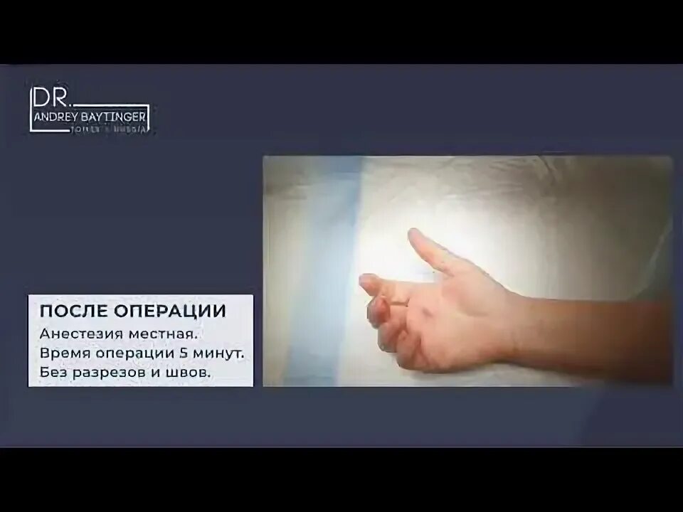 Болезнь нотта форум. Болезнь нотта щелкающий палец. болезнь нотта операция. щелкающий палец операция. болезнь нотта после операции.