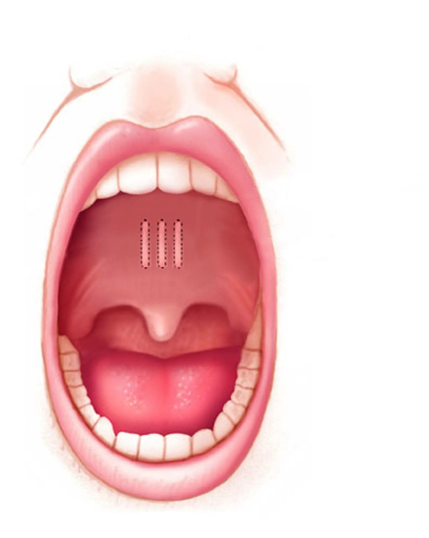 на горле какие точки