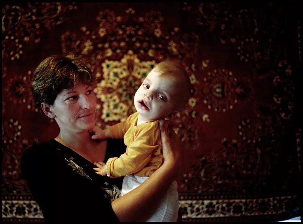 Чернобыльской аэс мутированные. Семья козловых чернобыль. Мутации после взрыва аэс чернобыль. Чернобыльская семья. Чернобыль припять 1986.