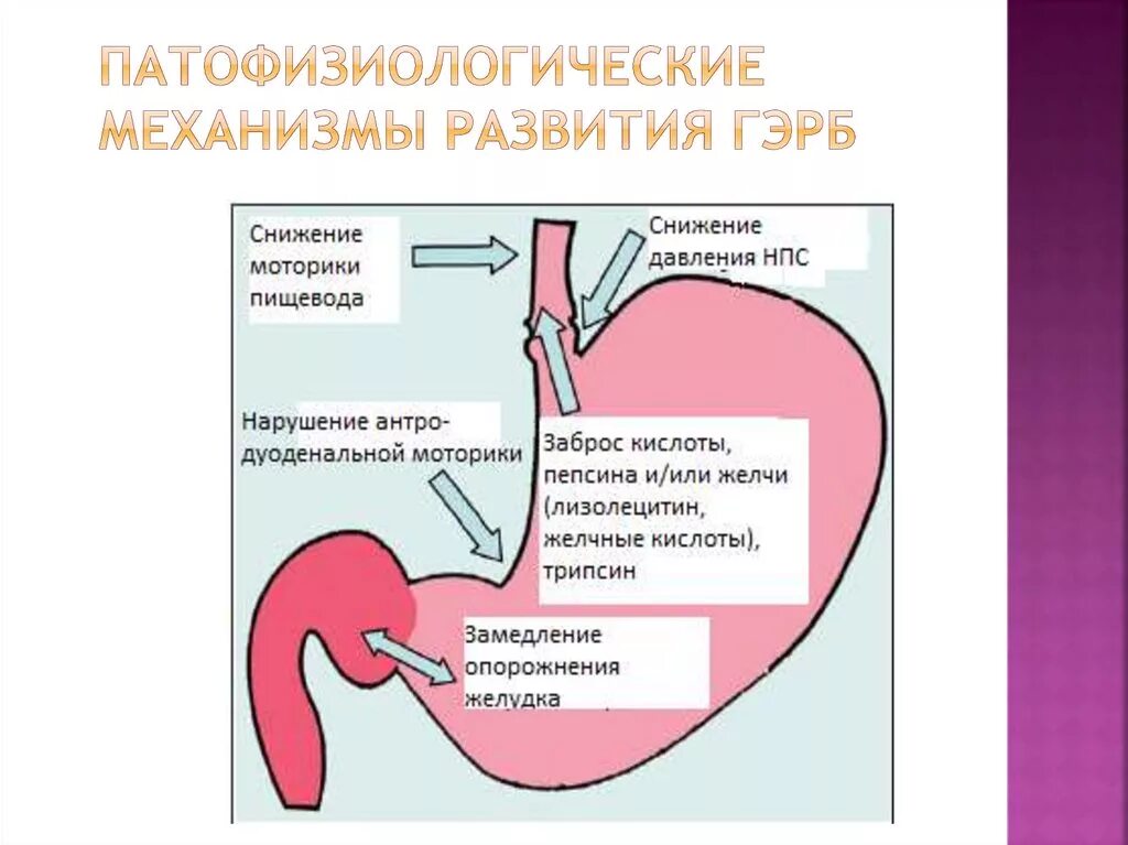 Заброс кислоты в пищевод симптомы