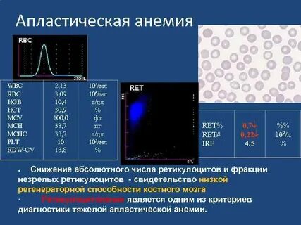 Анализ показывающий анемию