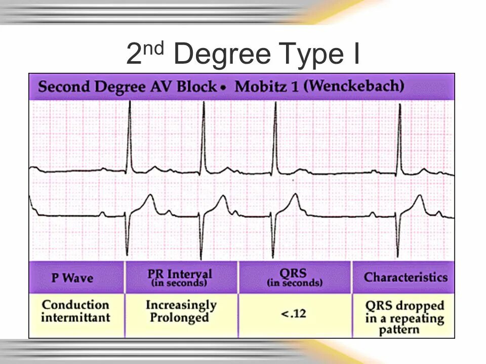 First second third degree price discrimination. Price discrimination. Second degree. Price discrimination degrees. Second degree av block type 2.