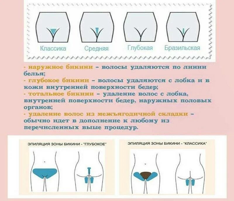 Схема роста волос в зоне глубокого бикини. Схема депиляции глубокого бикини воском. Неглубокое бикини депиляция схема. Зоны эпиляции классического бикини схема. Надо брить интимную зону мужчине