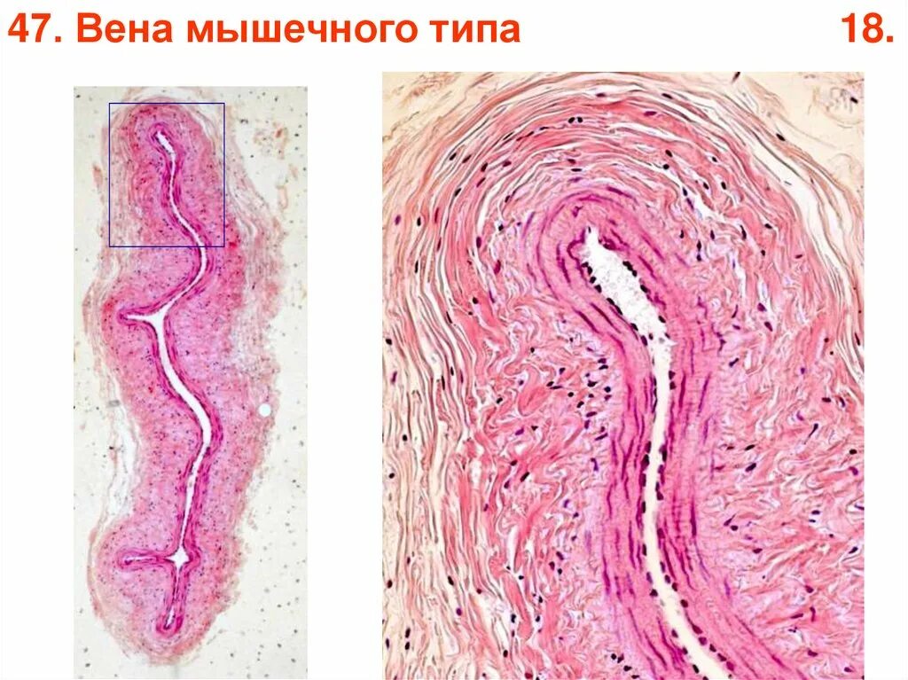 Строение сосуда гистология. Вена мышечного типа препарат гистология. вена безмышечного типа гистология препарат. бедренная вена препарат гистология. мышечная вена гистология препарат.