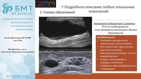 Классификация узи