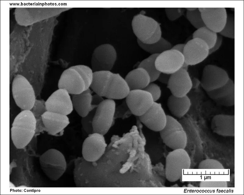 Enterococcus faecalis