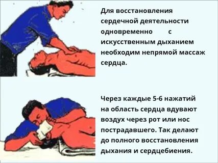 Прекращение сердечной деятельности и дыхания