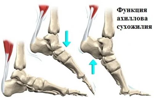 Укороченное сухожилие. Ахиллесово сухожилие разрыв. Разрыв ахиллова сухожилия голеностопного сустава. Иннервация ахиллова сухожилия.