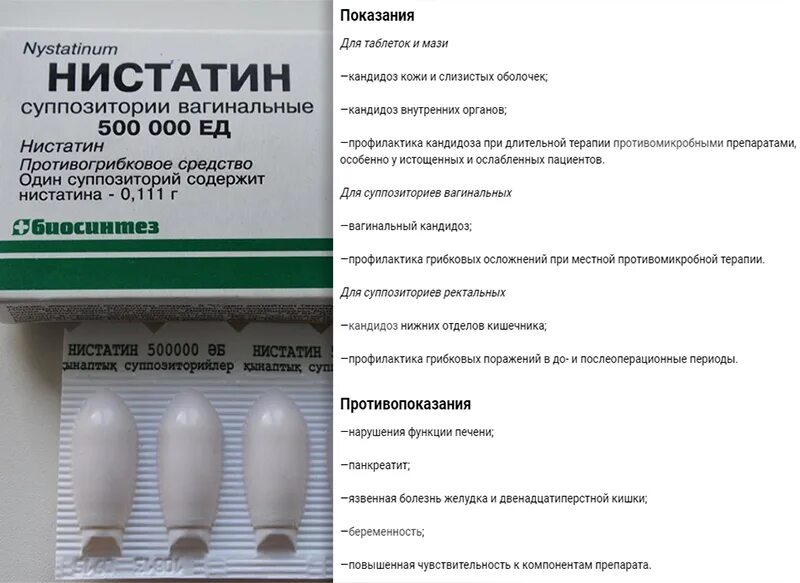 Молочница во время беременности 1 триместр. Таблетки от молочницы для женщин при беременности 2 триместр. свечи от молочницы 2 триместр беременности. свечи от молочницы при беременности во 2 триместре. свечи от молочницы для беременных в 3 триместре беременности.