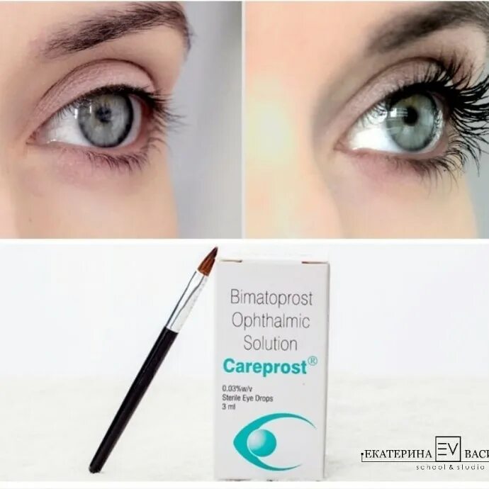 Средство для роста ресниц careprost (3 мл). Карепрост рост бровей. Капли для роста ресниц careprost. Карепрост рост бровей. Careprost (карепрост) средство для роста ресниц 3мл.