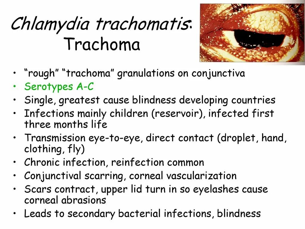 Chlamydia trachomatis характеристика. Хламидия трахоматис описание. Хламидиоз трахоматис конкретные факты.