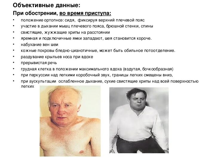 Положение больного при бронхиальной астме. Вынужденное положение при бронхиальной астме.