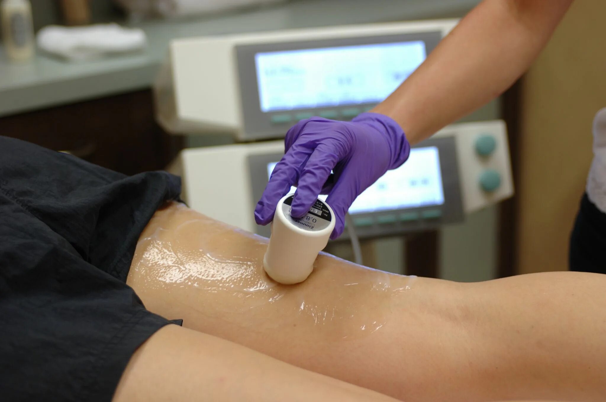 Лазерная депиляция аппаратный. Аппарат кандела для лазерной эпиляции. Операция эпиляция. Лазерная эпиляция. Диодный лазер shr bl1.