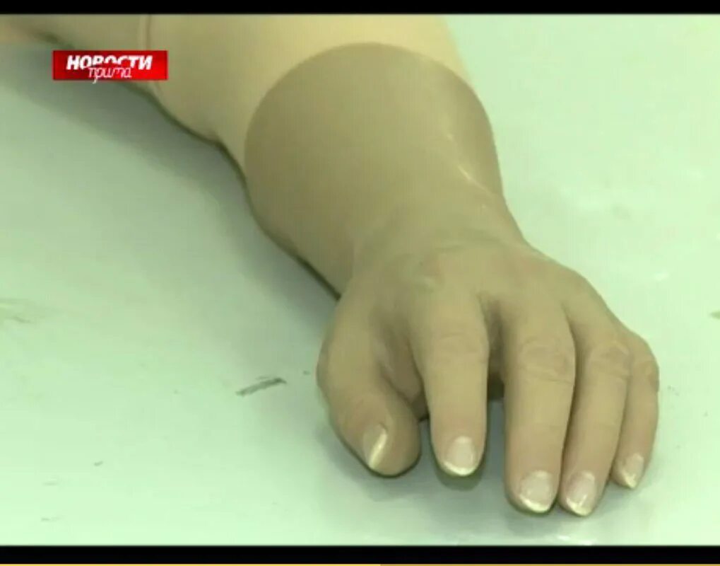 002. красноярское протезирование. аттачмены для бюгельных протезов. съёмные протезы зубов. красноярское протезирование.