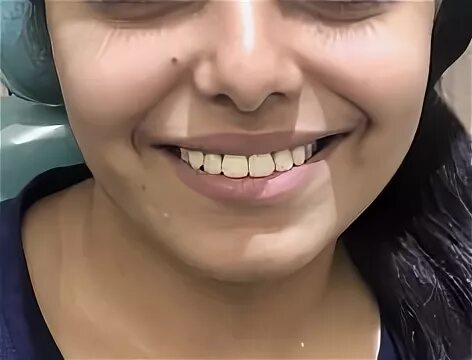 Smiling curve