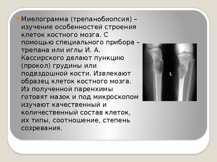 Костный мозг подвздошной кости. Трепанобиопсия бедренной кости. Трепанобиоптат костного мозга. Трепанобиопсия подвздошной кости. Трепанобиопсия из подвздошной кости.