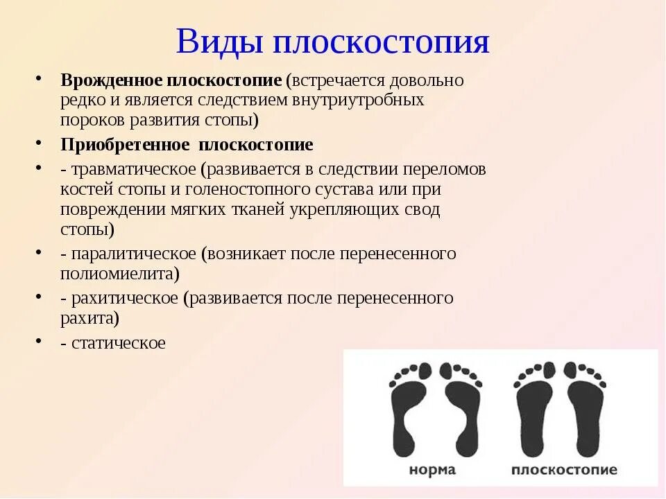 Свод стопы лечение