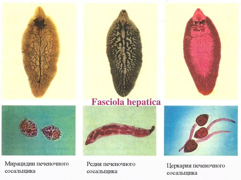 Сосальщик печеночный hepatica. Сосальщики черви представители. Сосальщики плоские черви. Черви плоские Fasciola hepatica. Сосальщик какой тип