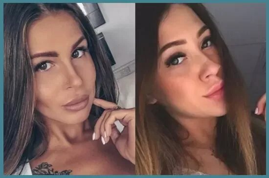 Анастасия голд до пластики фото