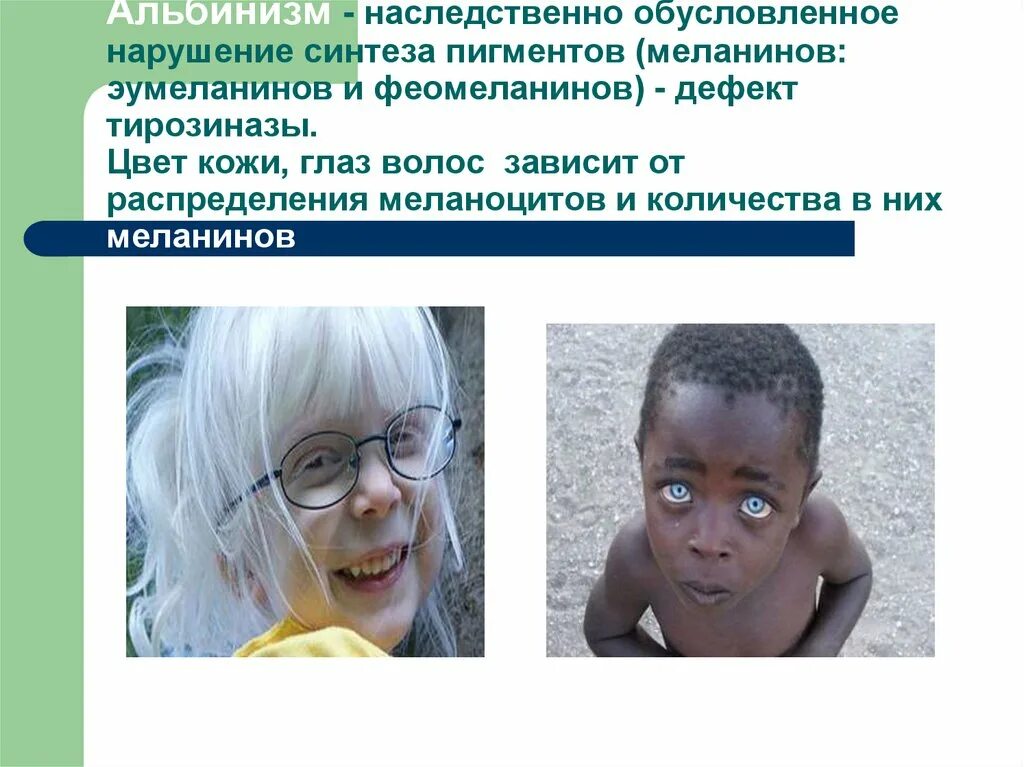 Альбинизм генетика. Альбинизм тип наследования. типы альбинизма у людей.