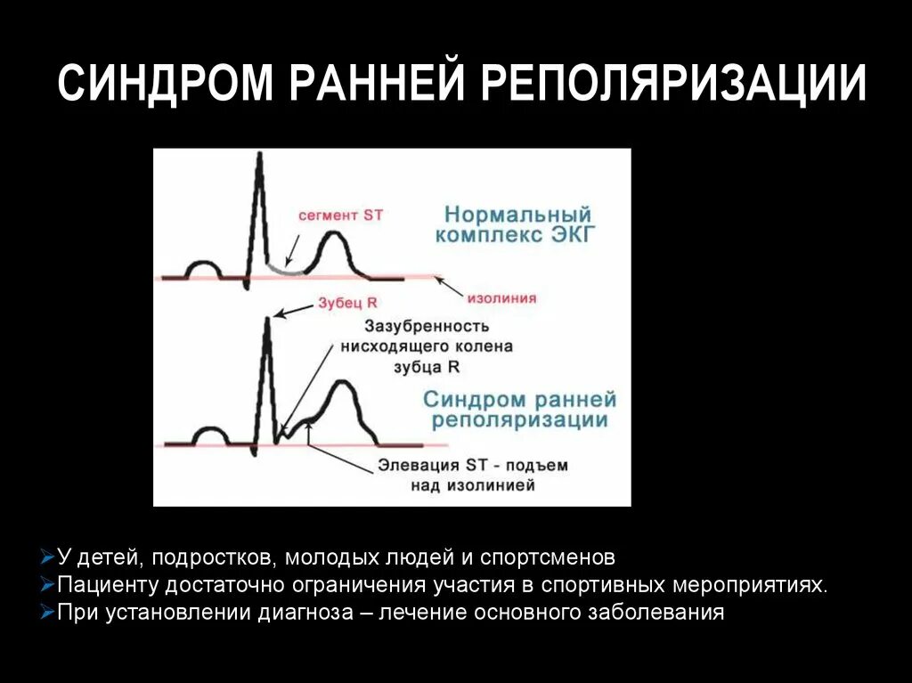 Умеренные изменения процесса реполяризации