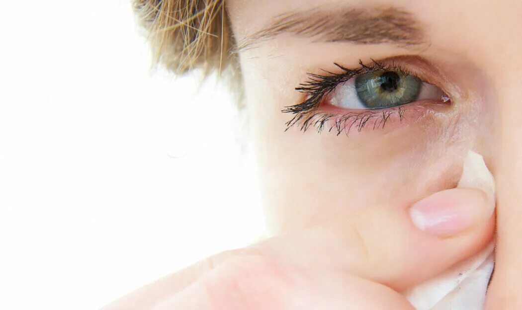 Заложенность носа слезотечение. Аллергия слезятся глаза.