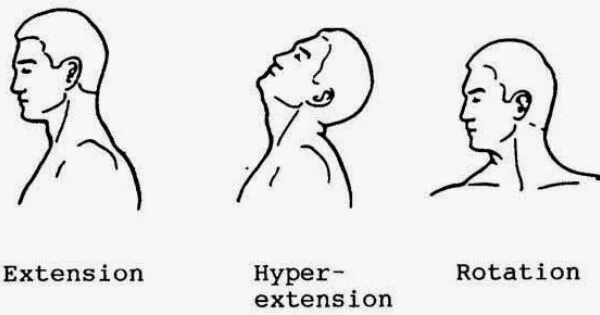 Extension vs extension. Lateral flexion neck. flexion extension. neck extension. neck rotation, lateral flexion or extension miners.