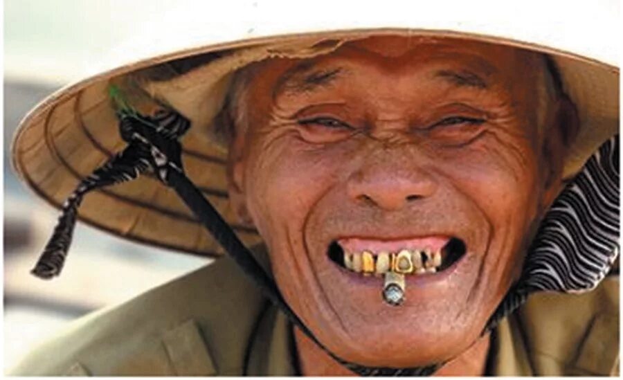 Бабушка с морщинами. Старые зубы. Старые зубы. Старые зубы. Бабка улыбается.