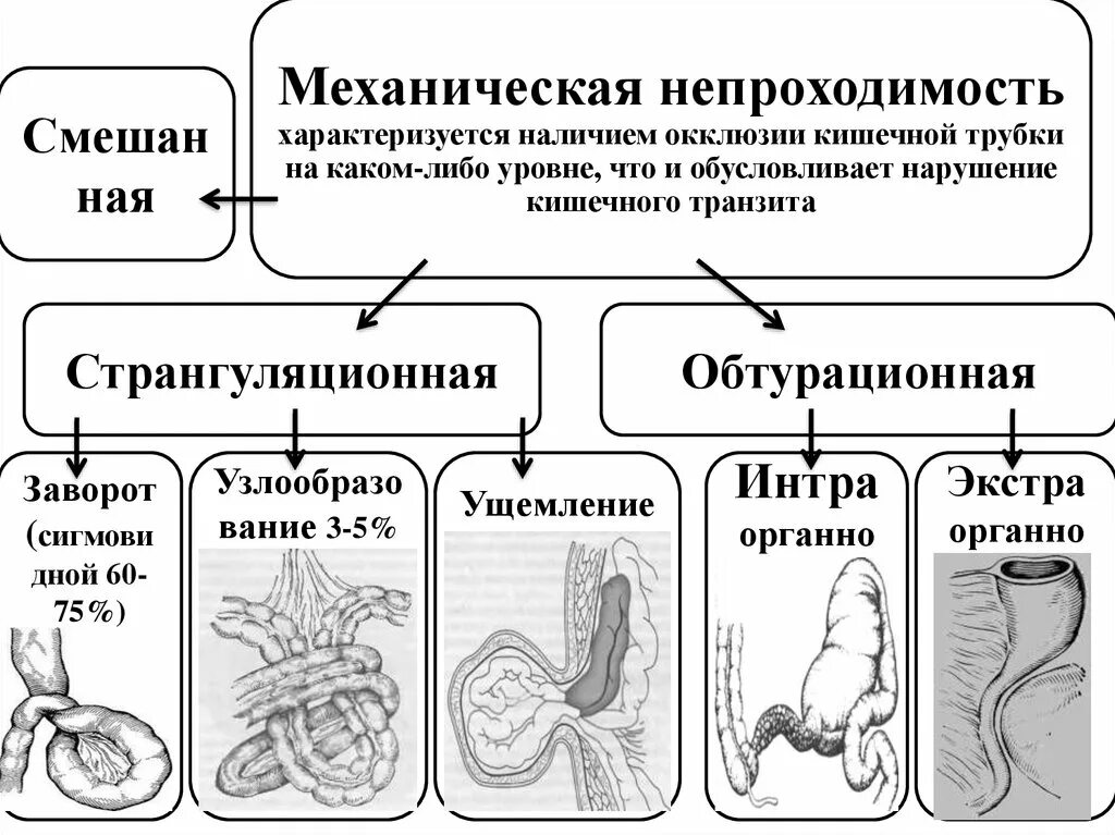 Слабительное при непроходимости. Классификация странгуляционной кишечной непроходимости. Странгуляционная непроходимость кишечника диагностика. Острая механическая кишечная непроходимость. Механическая обтурационная кишечная непроходимость.