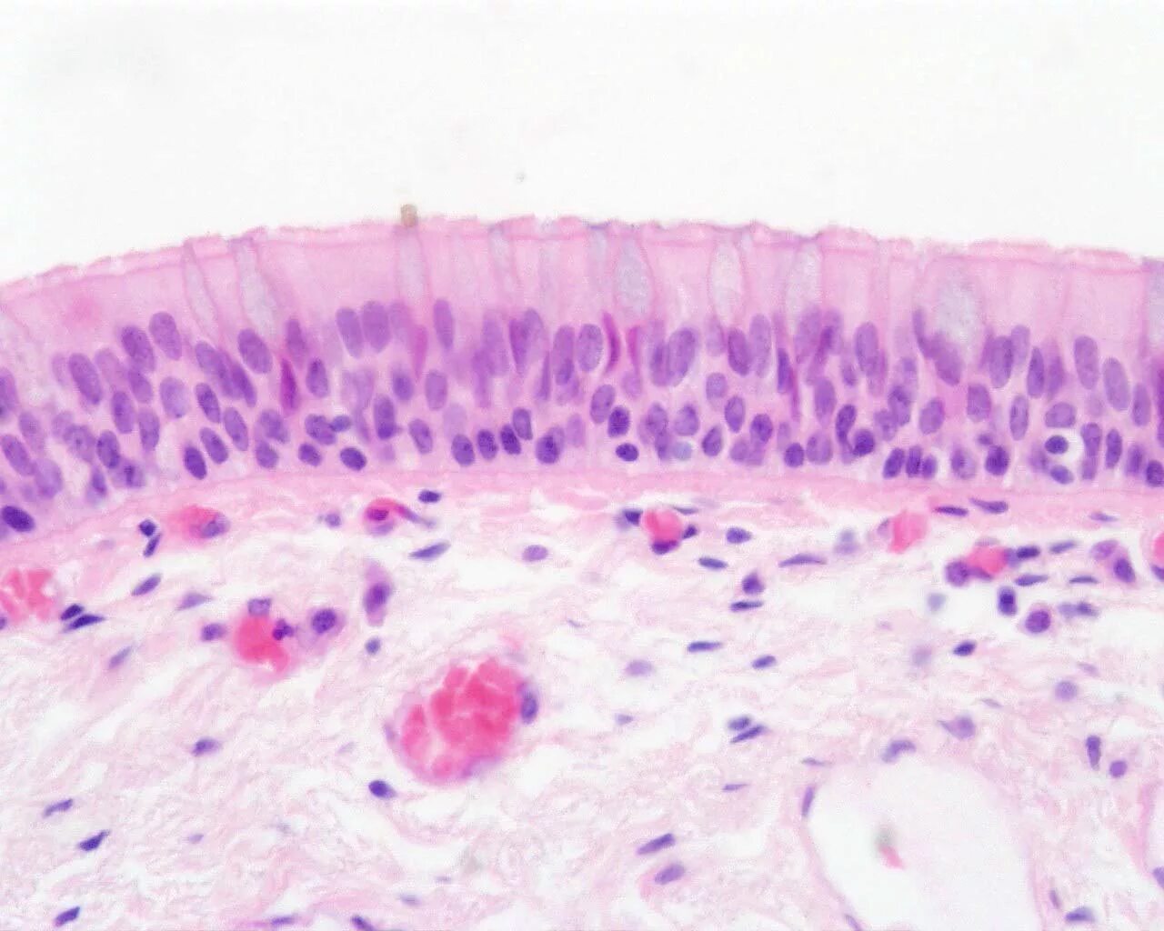 Слизистые клетки секрет. Многорядный эпителий гистология. Мерцательный эпителий гистология. Однослойный мерцательный эпителий гистология. Однослойный многорядный мерцательный эпителий трахеи препарат.