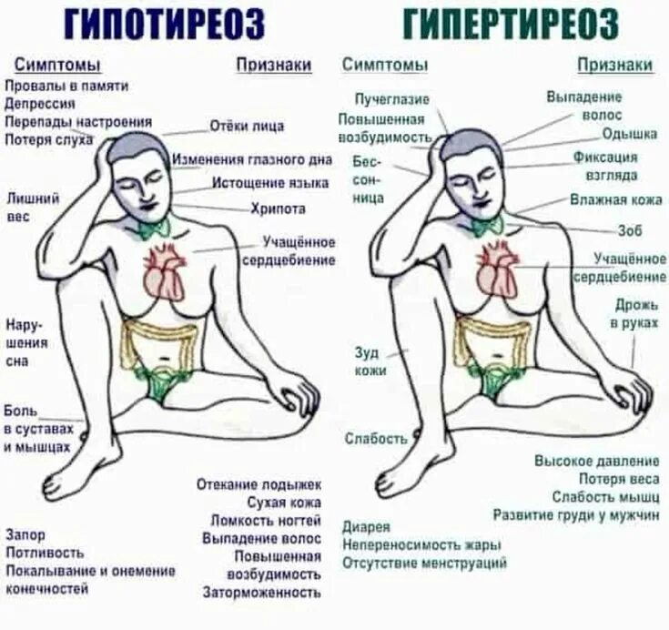 Гипотиреоз что это симптомы у мужчин. Гипотиреоз и гипертиреоз фото. Гипертиреоз щитовидной железы и гипотериоз. Причины первичного гипотиреоза. Щитовидная железа симптомы заболевания у женщин гипотиреоз.
