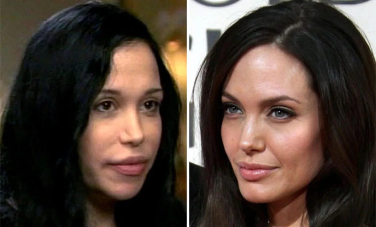 Становлюсь похожей на мать. Ринопластика звезд. Анджелина Джоли делала пластику носа. Анджелина Джоли до ринопластики. Анджелина Джоли пластические операции.