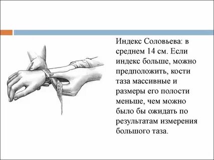 Размер таза индекс соловьевой
