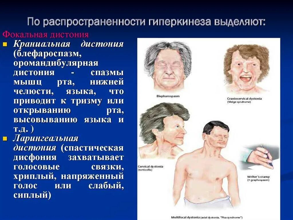 Болезнь непроизвольные движения