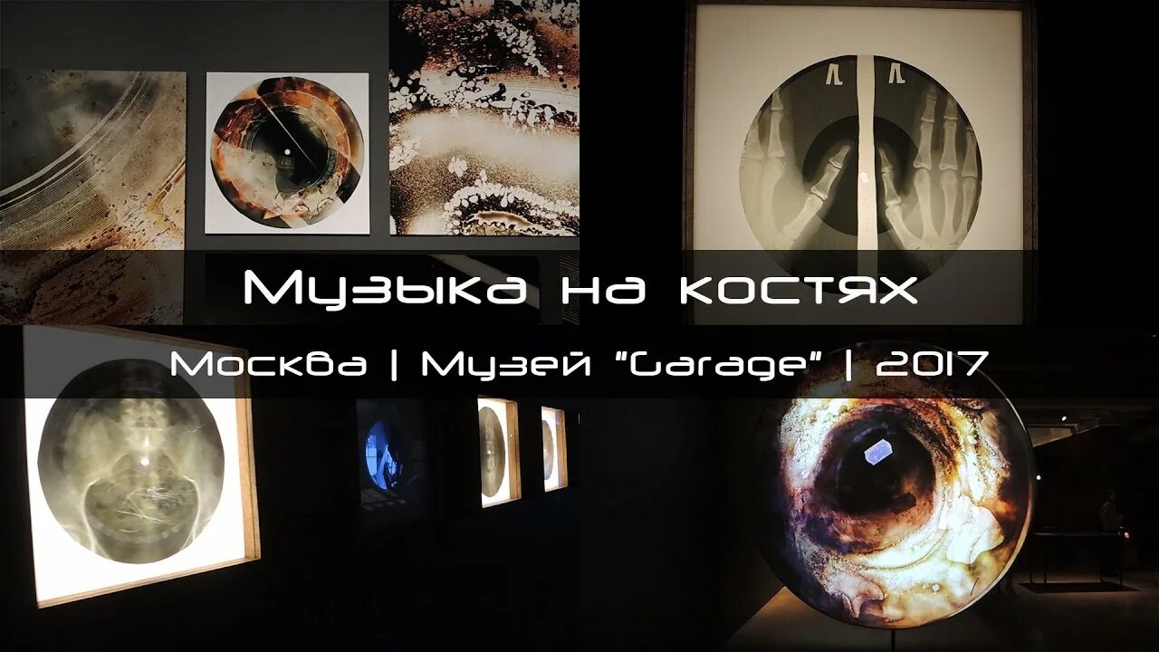 Виниловые пластинки на рентгеновских снимках. Музыка на костях ссср. Музыка на костях. Виниловые пластинки из рентгеновских снимков. Слушать музыку на костях.