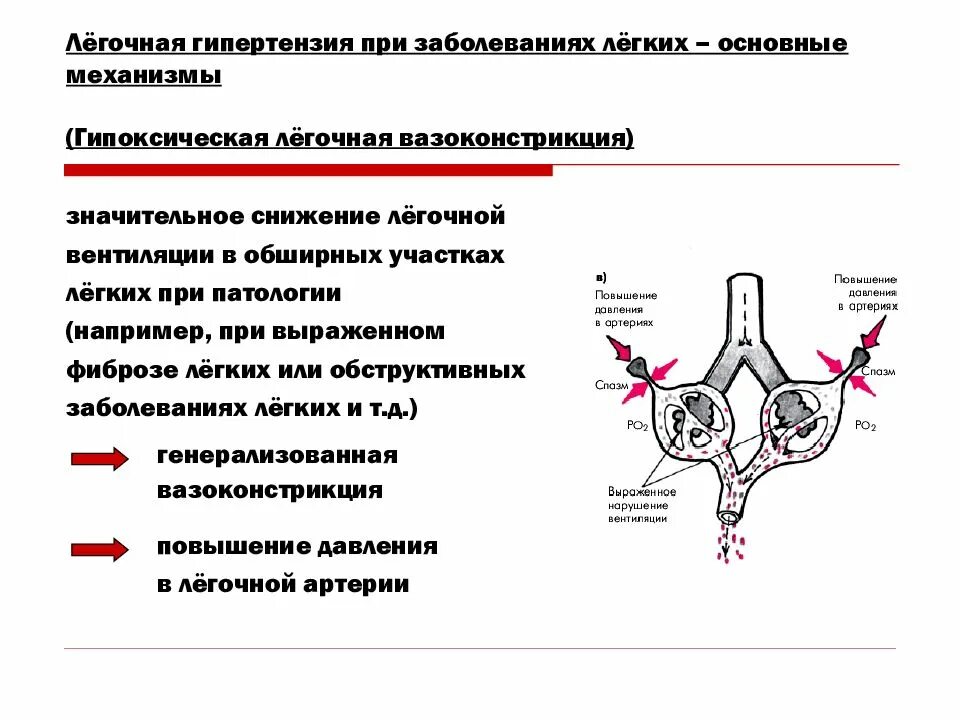 Легочная гипертензия. Легочная гипертензия при. Механизм легочной гипертензии. Ретроградная легочная гипертензия.