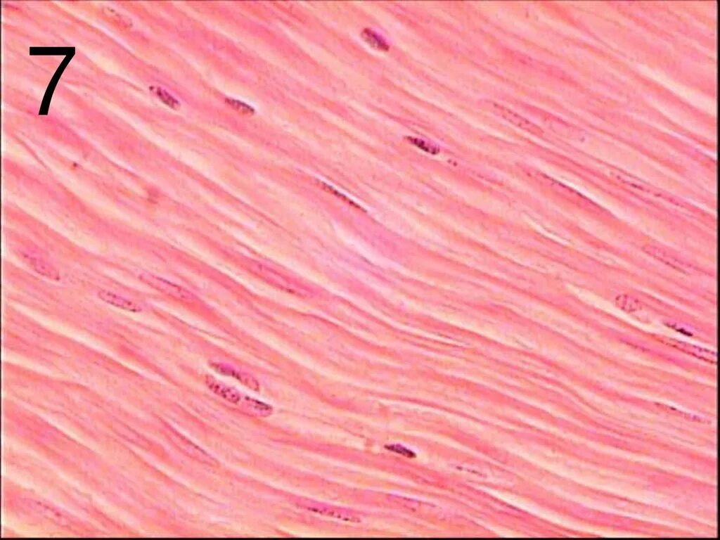 Гладкие мышцы многоядерные. Гладкая мышечная ткань гистология. Гладкая мышечная ткань микропрепарат. Гладкомышечная ткань гистология. Гладкая мускулатура микропрепарат.