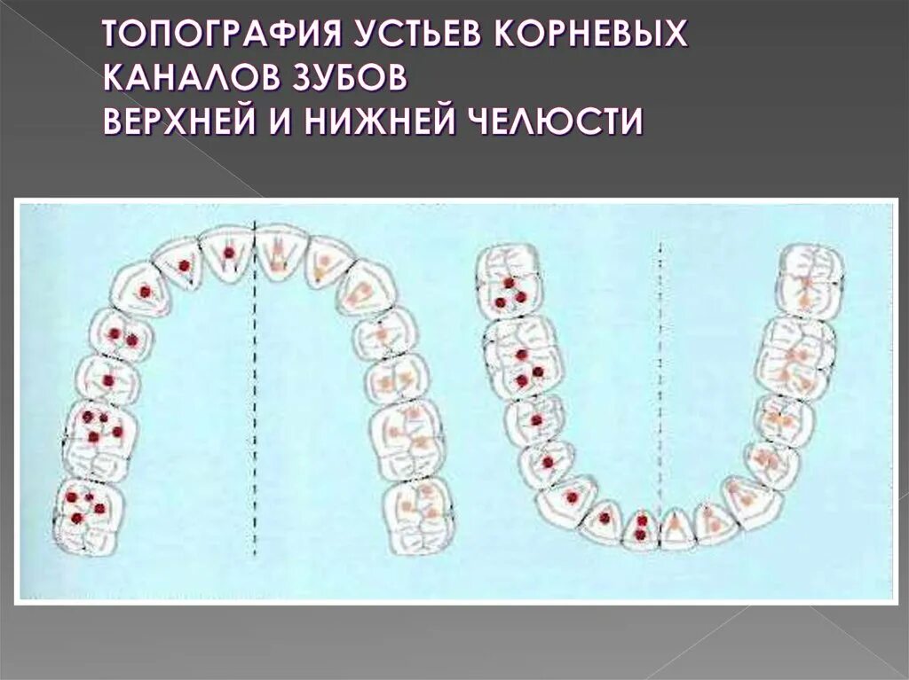 Верхние и нижние каналы. Корневые каналы верхней челюсти. Анатомия корневых каналов зуба 2.6. Анатомия корневых каналов 16 зуба. Топография устьев корневых каналов зубов нижней челюсти.