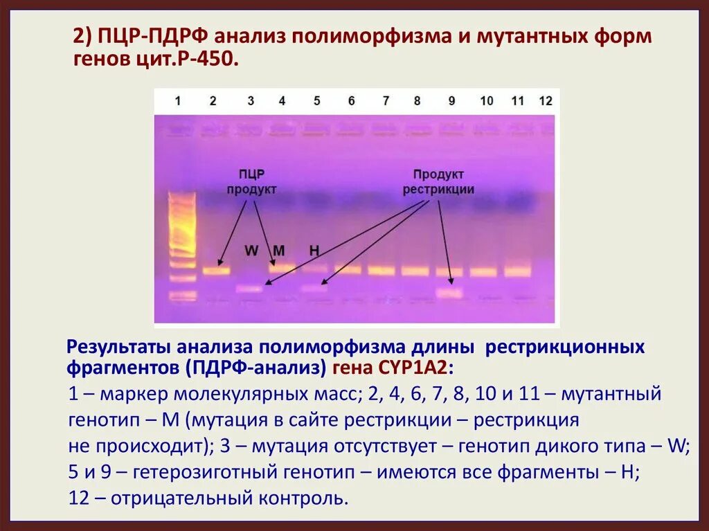 Вариант полиморфизма в гетерозиготной форме что это. Анализ полиморфизма длин рестрикционных фрагментов. пцр пдрф анализ. пдрф метод в генетике. полиморфизм длины рестрикционных фрагментов пдрф.