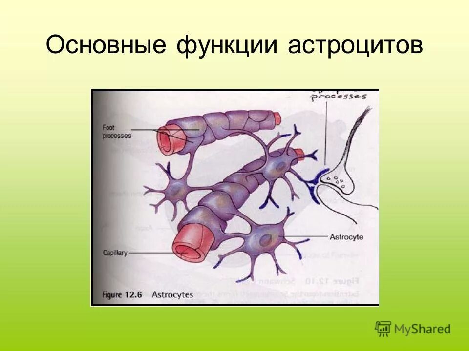 Астроцит клиника