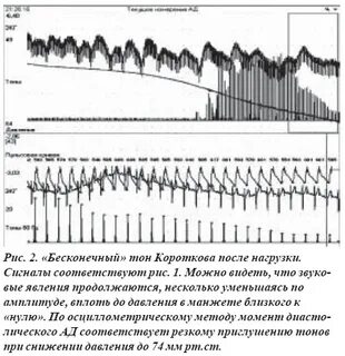 Тоны давления
